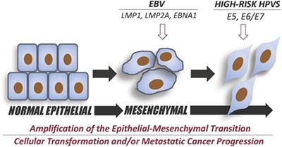 Epstein–Barr Virus and Human Papillomaviruses Interactions and Their Roles in the Initiation of Epithelial–Mesenchymal Transition and Cancer Progression